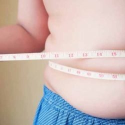 alabama weight loss surgery