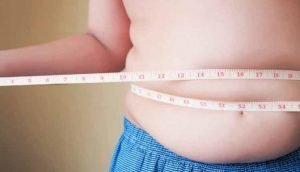 alabama weight loss surgery